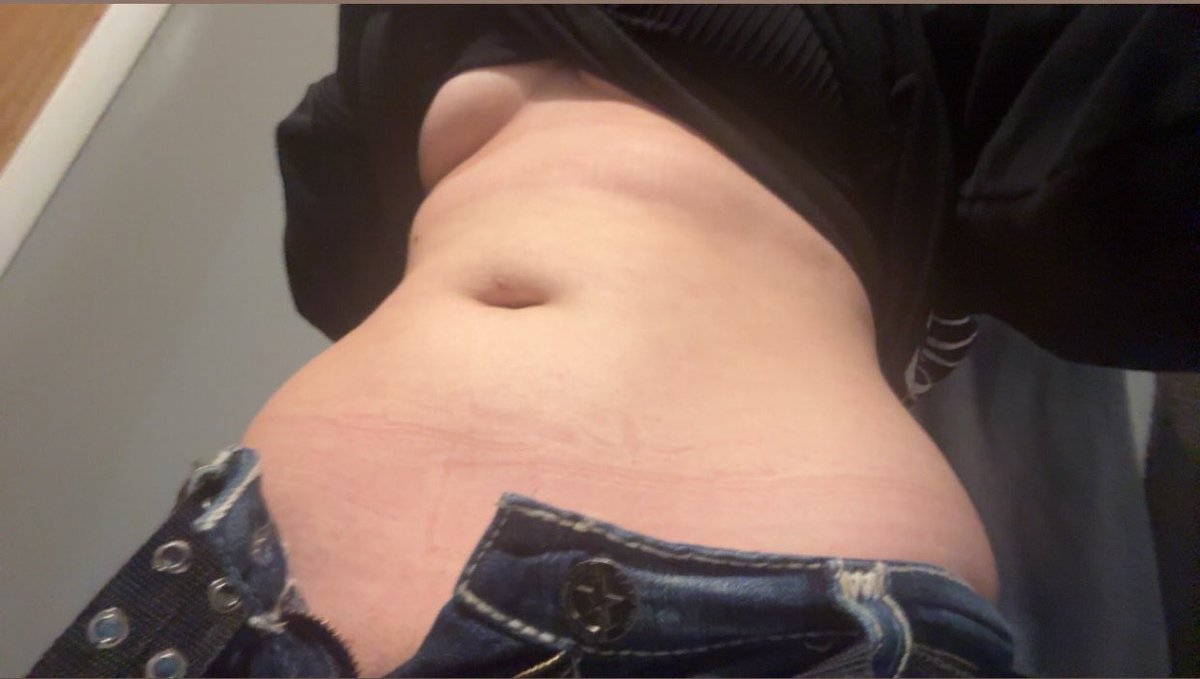 Stwarlite's tweet photo. tummy https://t.co/OgMV0zqPfn
