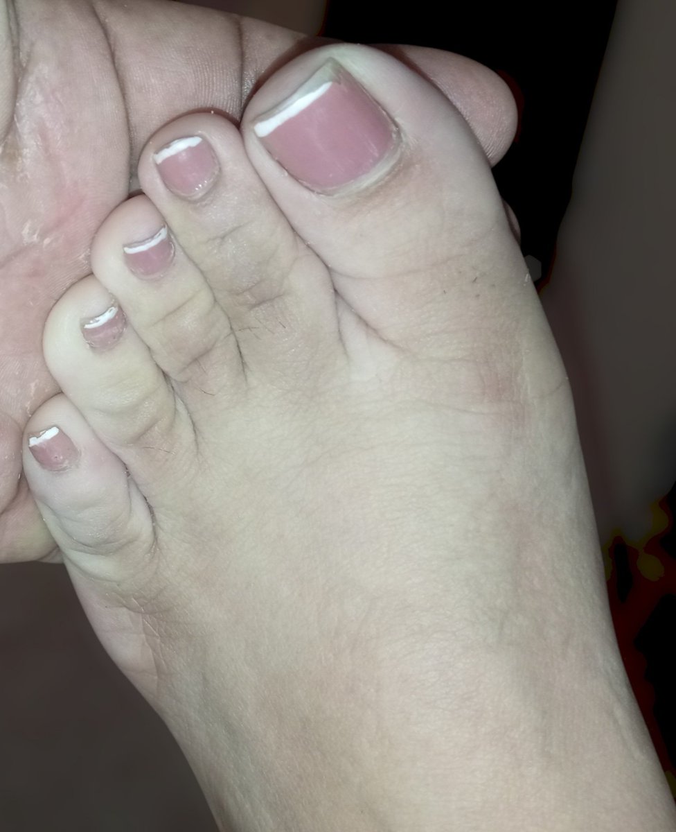 carminafeet12's tweet photo. La recámara se prendió a queso 🤭��🏼🧀👣 #pies #piessudados #olor #oloraqueso #piesudados #dedos #dedogordo #deditos #footfetısh #feetfetısh #natural #foot #closeup #pedicure #french #pedicurefrench #pedicurefrancés #uñas #fetish #fetiche #fetichistas #fetichedepies #uñas #soles https://t.co/JLFKmbakfz