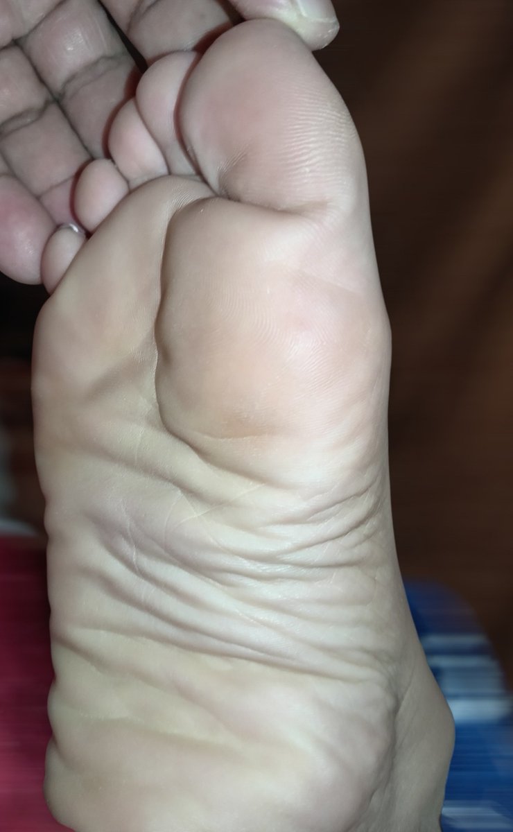 carminafeet12's tweet photo. La recámara se prendió a queso 🤭��🏼🧀👣 #pies #piessudados #olor #oloraqueso #piesudados #dedos #dedogordo #deditos #footfetısh #feetfetısh #natural #foot #closeup #pedicure #french #pedicurefrench #pedicurefrancés #uñas #fetish #fetiche #fetichistas #fetichedepies #uñas #soles https://t.co/JLFKmbakfz