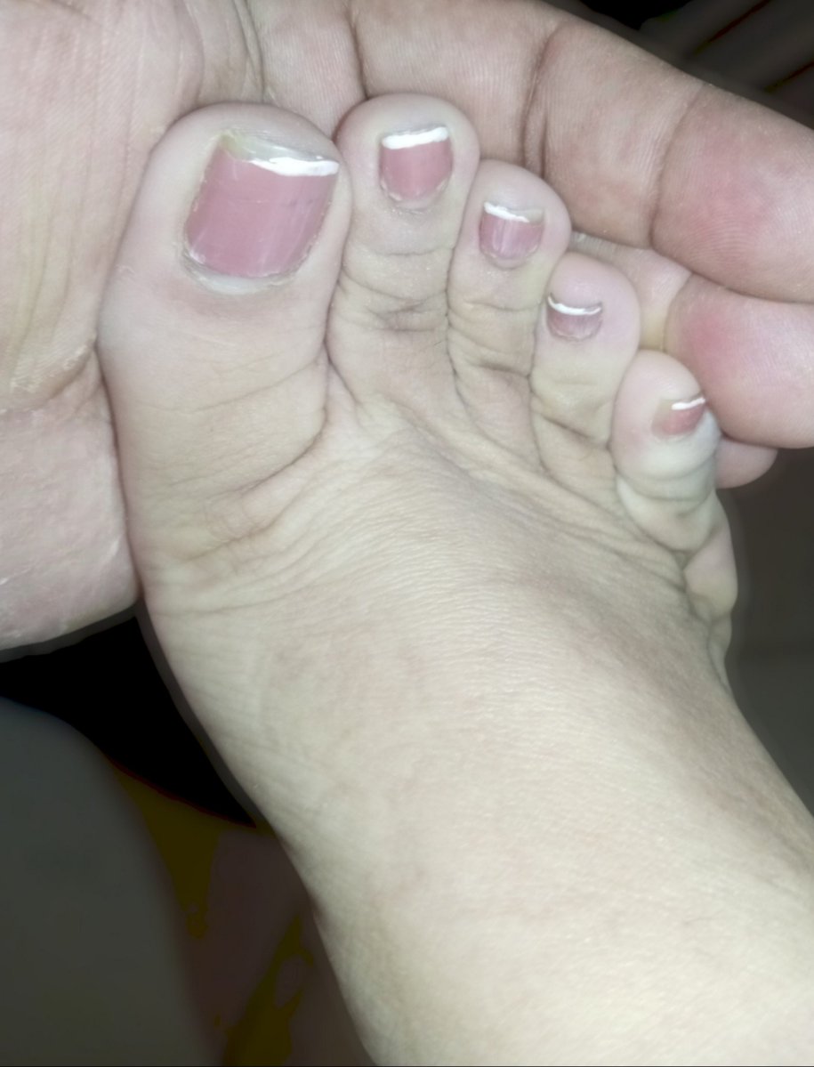 carminafeet12's tweet photo. La recámara se prendió a queso 🤭��🏼🧀👣 #pies #piessudados #olor #oloraqueso #piesudados #dedos #dedogordo #deditos #footfetısh #feetfetısh #natural #foot #closeup #pedicure #french #pedicurefrench #pedicurefrancés #uñas #fetish #fetiche #fetichistas #fetichedepies #uñas #soles https://t.co/JLFKmbakfz