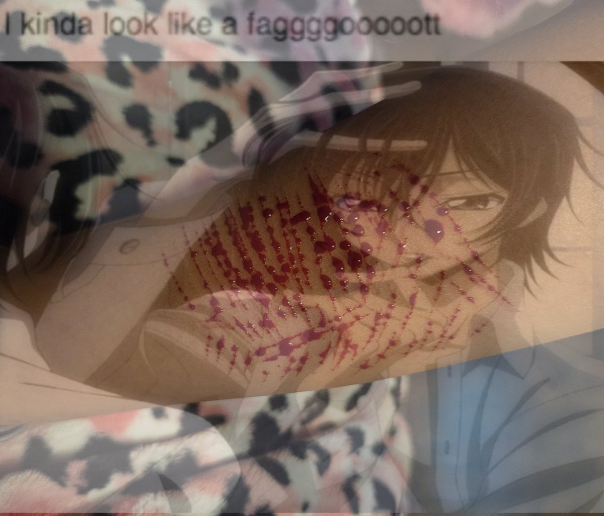 sweetestcorpse's tweet photo. I got bored ૮ ◞ ﻌ ◟ ა fake its all fakeᵎᵎ halloween practice owie so real wow
#babystyro #sharm #shredtwt
#ouchietwt https://t.co/eWbZmvVtuq