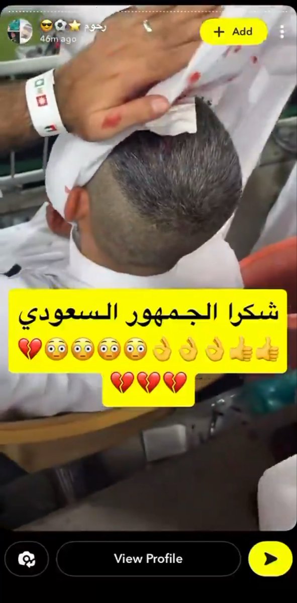 POOO00PO00's tweet photo. @david_uk12 @jxksa123 اااااخ يارااااااسسيي😂😂😂😂😭😂😭😭😂😂😂😂😂 https://t.co/bm6Lmtjtqq