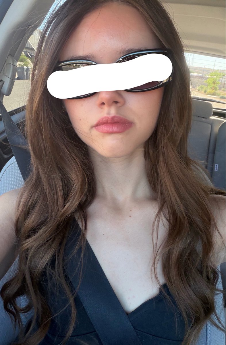 bruiisedbunnii's tweet photo. another hw vs now of my face

look disgusting in both but i need to remember why i can’t fucking binge anymore https://t.co/Jfv0A6yqnI