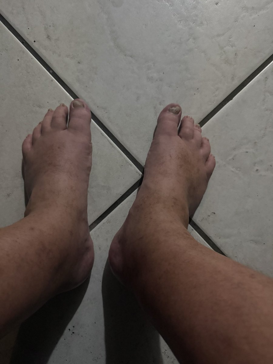 SpacesFacts's tweet photo. “I don’t think they’re fixable, I tried with Doug.” -@iristai04 to @kayakbeaadt about his feet. https://t.co/f7xgOKFX49