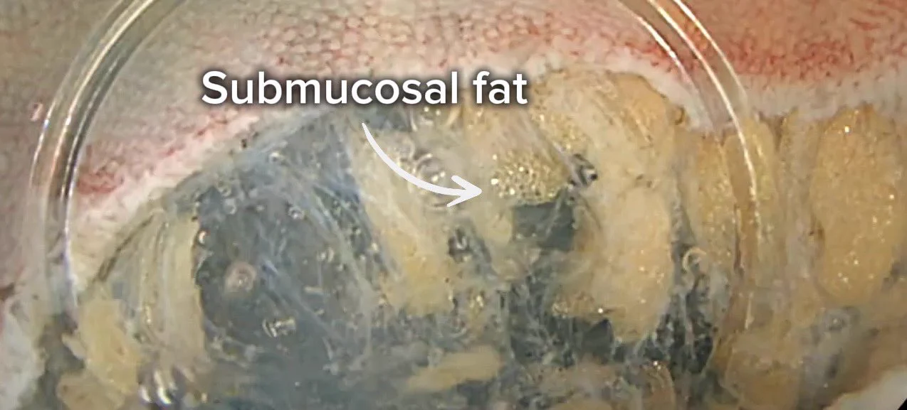 Ash Almomani, MD on X: 