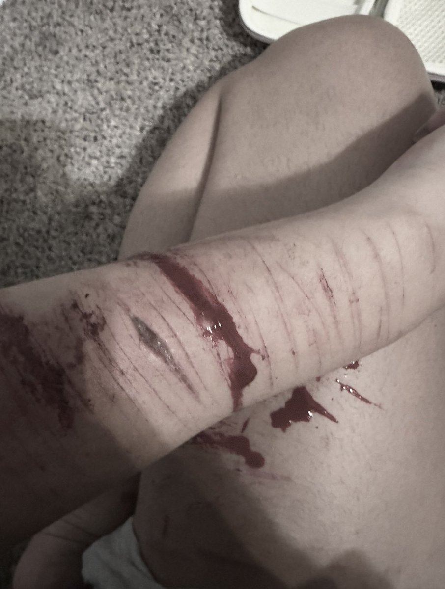 r4insh's tweet photo. Fake sfx makeup #sh #fakesfx #makeup #shtwtt https://t.co/B3ZvnXsn4d