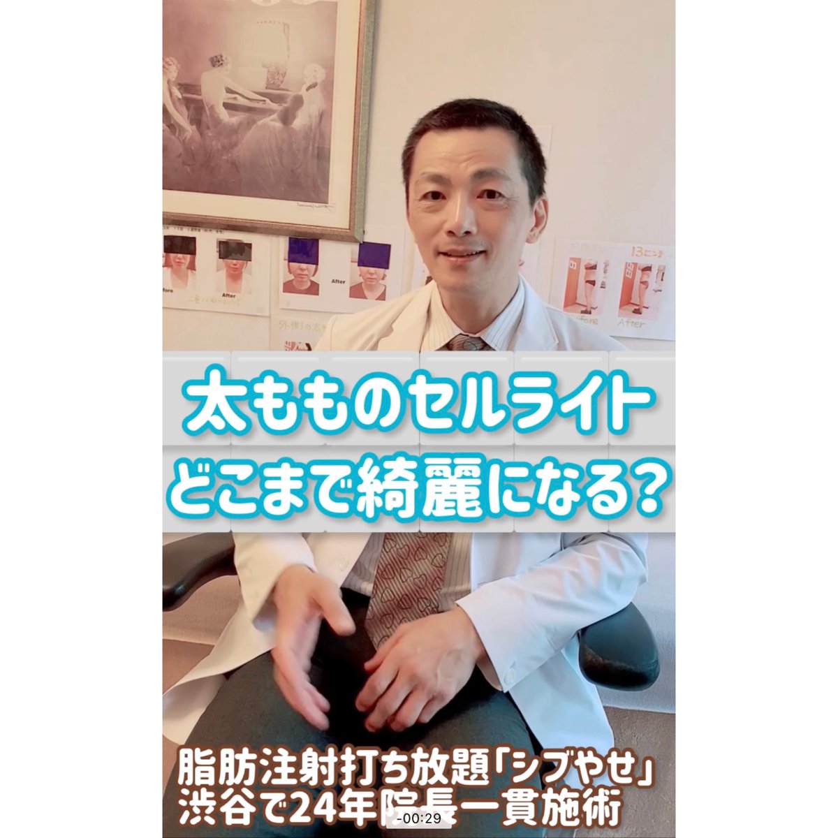 bunkast's tweet photo. 太もものセルライト、どこまで綺麗になる？脂肪の量によって施術の順番や注射の打ち方も変わります。太もも痩せ・セルライトへの脂肪溶解注射打ち放題につ... https://t.co/nAaD6ENeLT @YouTubeより https://t.co/UVBNaMKe8U