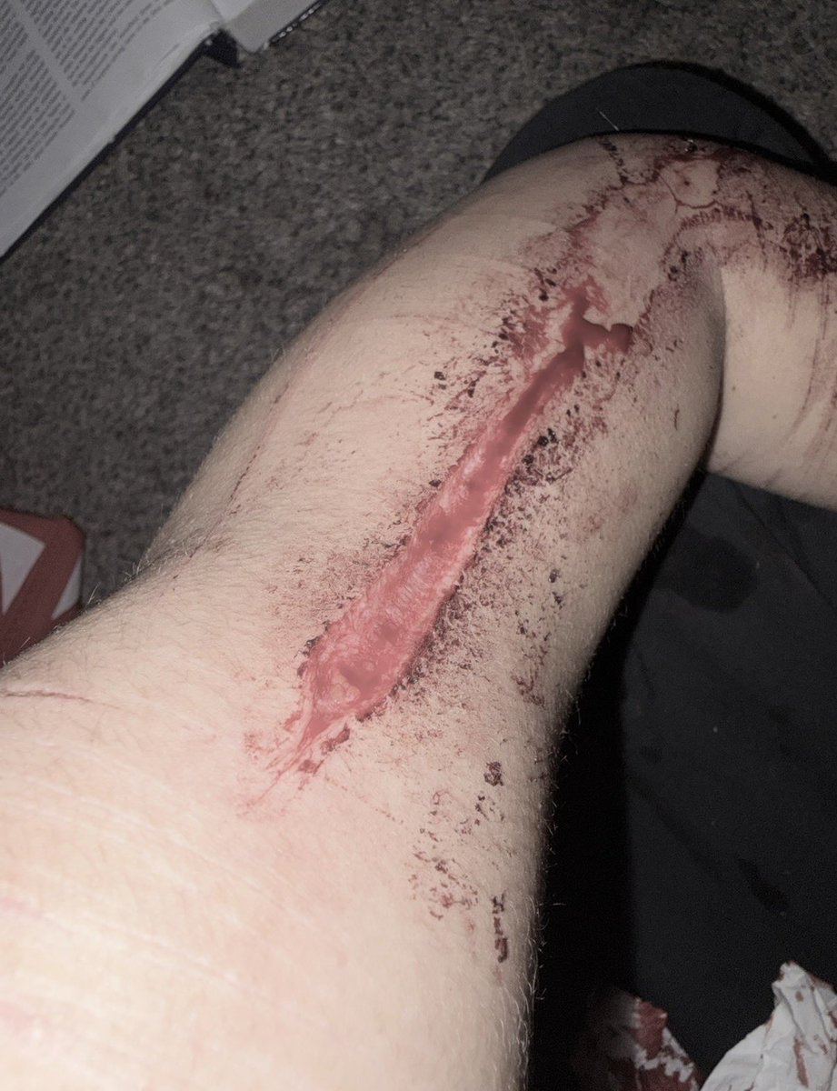 r4insh's tweet photo. Fake sfx makeup #sh #shtwt #notreal #sfxmakeup https://t.co/TQ3eLI56wC
