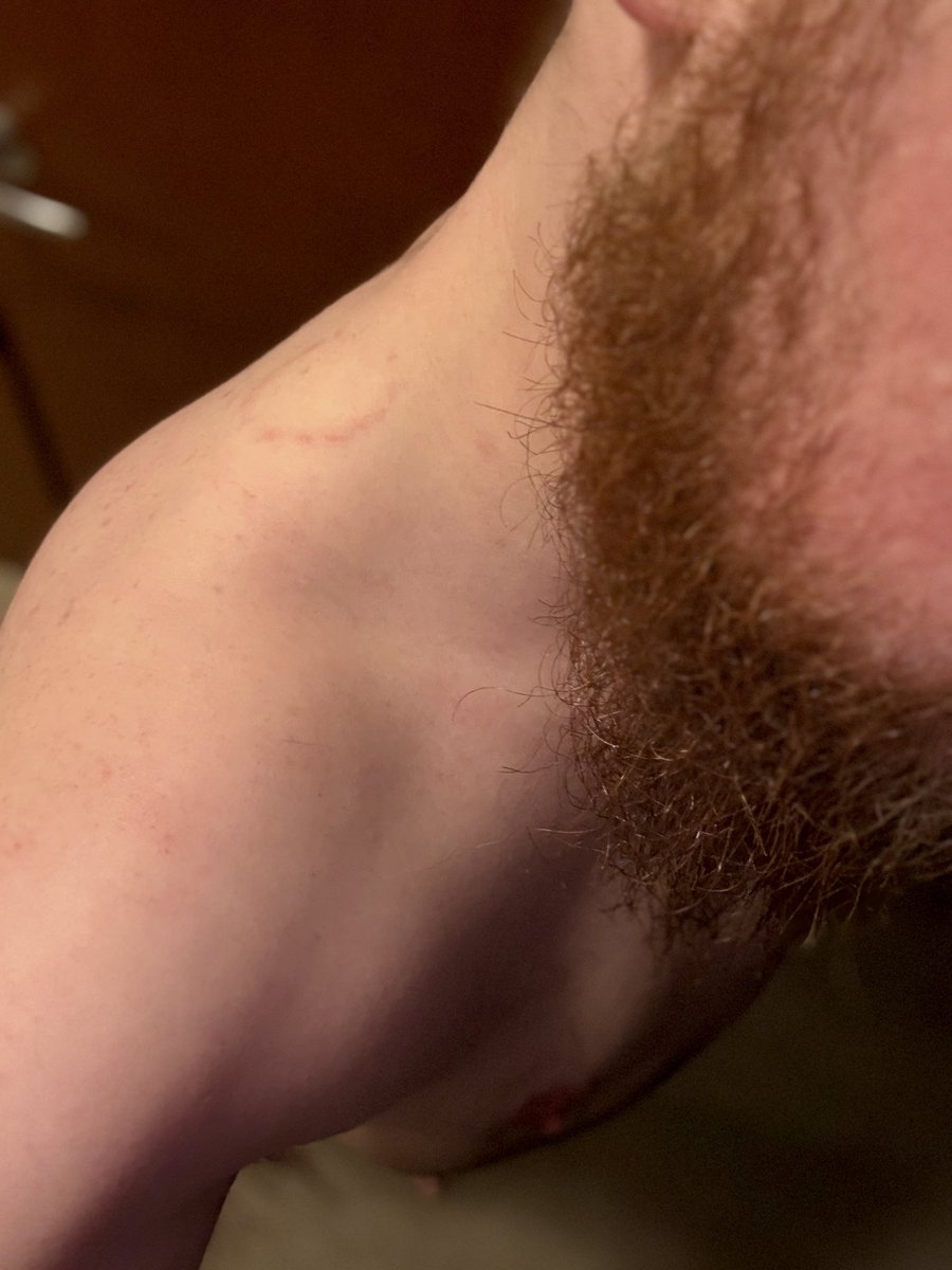 TydeCub's tweet photo. Oh, and the marks on my ass disappeared but he made sure one stuck around 😜 #gaybear https://t.co/uC3xDbTGKM