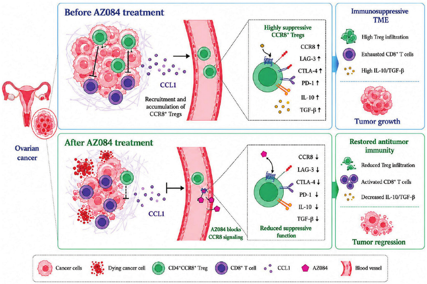 jcaopl's tweet photo. ✨#CancerScience 10/2026 ハイライト論文紹介✨

Selective Depletion of Tumor-Infiltrating CD4+CCR8+ Tregs by AZ084, a Novel CCR8 Antagonist

Yepeng Mao, Ziqi Tao, Shuna Liu, Zhijie Liu, Fang Wang et al.

1: Department of Laboratory Medicine, The First Affiliated Hospital with Nanjing Medical University, Nanjing, China
2: Branch of National Clinical Research Center for Laboratory Medicine, Nanjing, China

卵巣がんは、特に進行期に診断された場合、治療が難しいがんです。その一因として、腫瘍が免疫反応を抑制する仕組みを持つことが挙げられます。本来は過剰な免疫反応を抑える制御性T細胞（Treg）が腫瘍内に集積すると、がん細胞を攻撃する免疫細胞の働きを抑えてしまいます。そのため、全身の免疫機能を損なうことなく腫瘍内のTregを標的とする方法が求められています。
本研究では、腫瘍内のTregで高発現するCCR8に注目しました。卵巣がんやメラノーマのマウスモデルにおいて、CCR8陽性Tregは他のTregより強い免疫抑制作用を示しました。そこで、CCR8を阻害する新規薬剤「AZ084」を用いたところ、Tregへの分化や免疫抑制能、腫瘍由来のシグナルに対する移動が抑制されました。
さらに、腫瘍を持つマウスにAZ084を投与すると、腫瘍の増殖と腫瘍内のCCR8陽性Tregが減少しました。一方で、CD8陽性T細胞の腫瘍への浸潤が増加し、抗腫瘍免疫に関与するインターフェロンγの産生も高まりました。また、脾臓の主要な免疫細胞への影響や臓器障害はほとんど認められませんでした。
これらの知見は、CCR8阻害が腫瘍内の免疫抑制を解除し、抗腫瘍免疫を高める新たな治療法となる可能性を示しています。ただし、ヒトでの有効性と安全性については、さらなる検討が必要です。

論文
https://t.co/FhN1zEVs4S

In this issue
https://t.co/lXg3VUlSGj

#AZ084 #CCR8 #chemokine #ovarian_cancer #regulatory_T_cells #卵巣がん #制御性T細胞
#日本癌学会 #JCA #がん研究