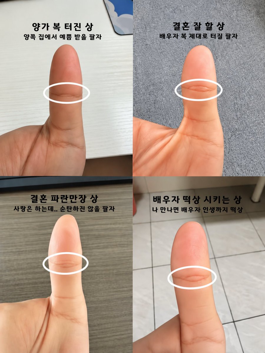 sozoogirl's tweet photo. 여러분 엄지손가락 펴보세요
결혼 팔자 다 나옴ㅋㅋㅋㅋㅋ
지금 엄지손가락 손금 한 번 보고 오세요!

👍 엄지 주름으로 보는 결혼운

🏠 양가복 터진 상 : 길고 완만한 선 + 아래 옅은 선
→ 양쪽 집에서 예쁨 받을 팔자

💍 결혼 잘할 상 : 가운데가 볼록! 눈처럼 생긴 선
→ 배우자 복 제대로 터질 팔자

💔 결혼 파란만장 상 : 선이 여러 겹 + 갈라지고 복잡함
→ 사랑은 하는데… 순탄하진 않을 팔자

💸 배우자 떡상시키는 상 : 굵고 선명한 선이 길게 쭉~
→ 나 만나면 배우자 인생까지 떡상