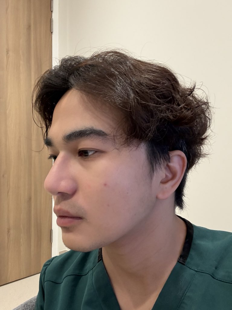 hmmico's tweet photo. Morning eye bags https://t.co/DQHhqOFZXt