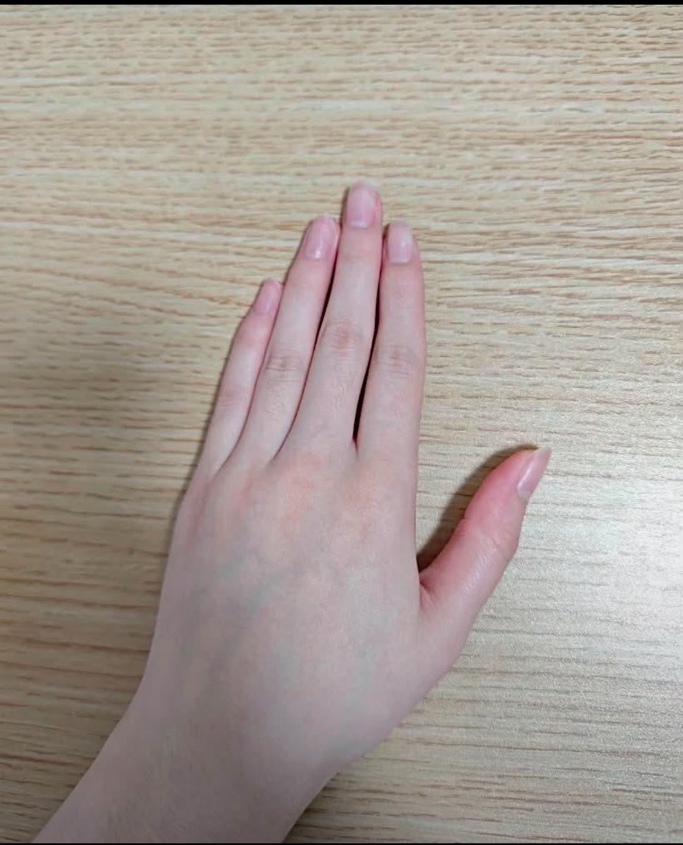 kyaracalista's tweet photo. hehehhehe sorry diriku tidak tahan untuk tidak share inii🫵🏻😭🫶🏻finnaly glass skin yang akuu mauu tanpa suntik”!! https://t.co/l8ffmAa0Jf