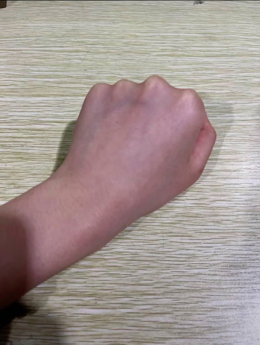 kyaracalista's tweet photo. hehehhehe sorry diriku tidak tahan untuk tidak share inii🫵🏻😭🫶🏻finnaly glass skin yang akuu mauu tanpa suntik”!! https://t.co/l8ffmAa0Jf