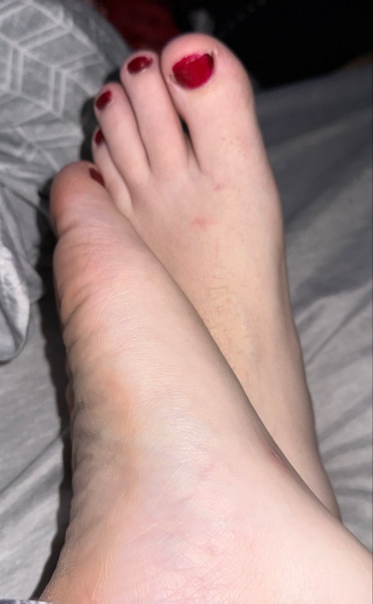 ValkyrieHeels's tweet photo. @FeetFinder https://t.co/uEs7JpJ1Rz https://t.co/C9G6CNIHbp