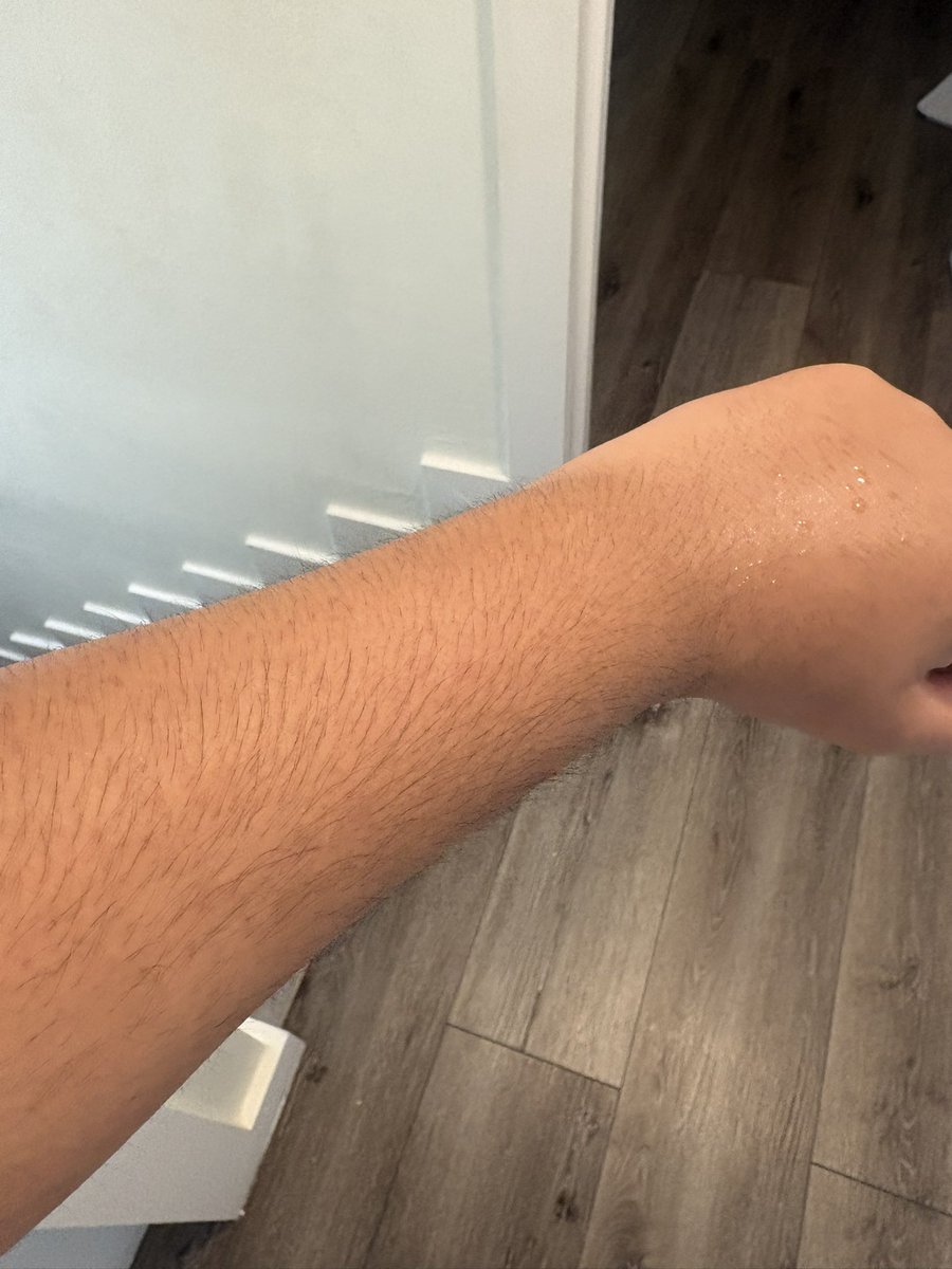 HitlessIII's tweet photo. Many people have said that im white just because i roleplay as hitler from mewgenics, im not black or white bro 🤦‍♂️ https://t.co/XwRjHzNyhQ