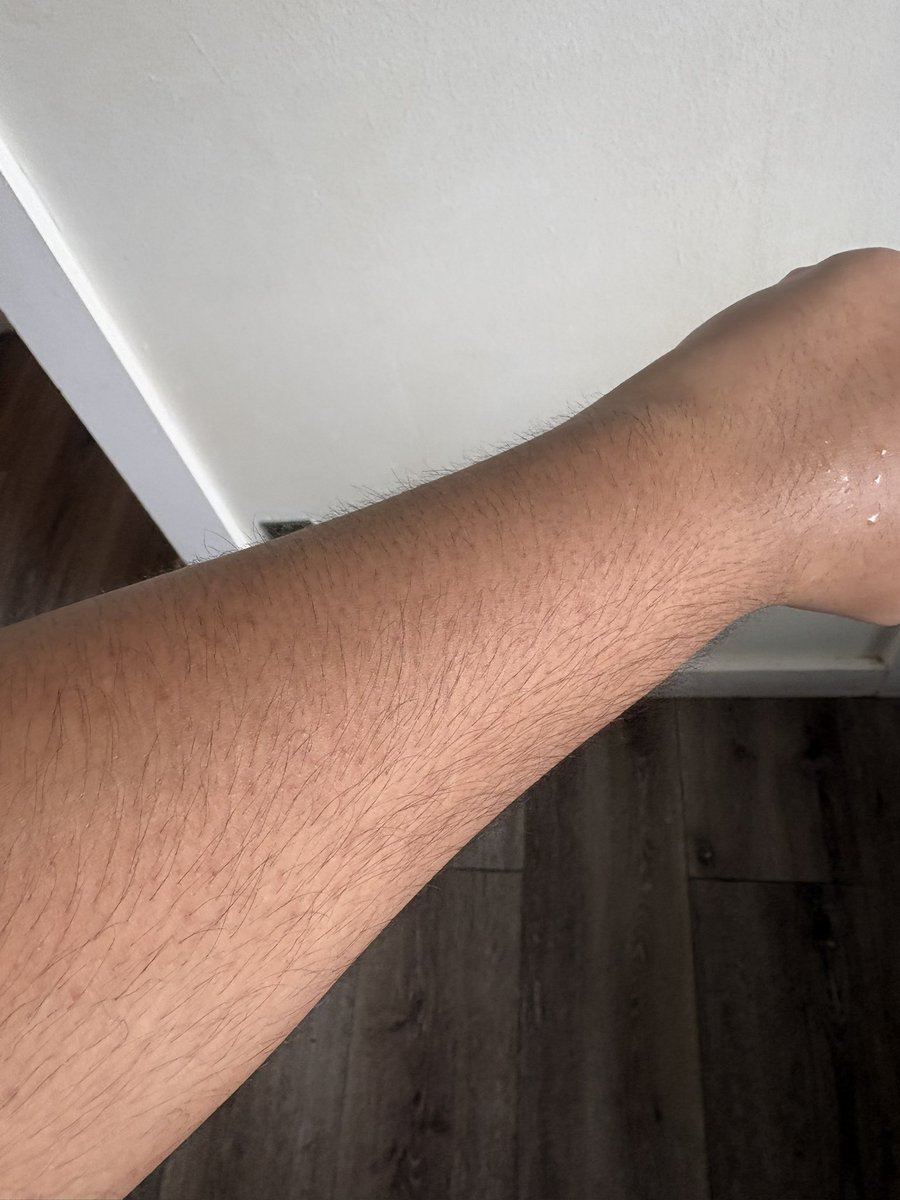 HitlessIII's tweet photo. Many people have said that im white just because i roleplay as hitler from mewgenics, im not black or white bro 🤦‍♂️ https://t.co/XwRjHzNyhQ