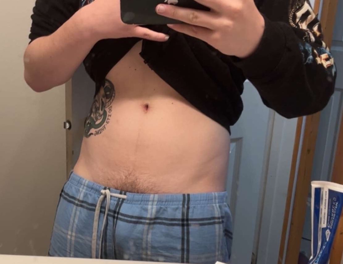 _bwehh's tweet photo. Tummy Tuesday or wtv https://t.co/SaVPysUvP3