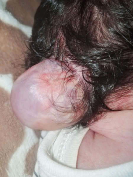 oday_ahmedo43h's tweet photo. My child has a tumor in his head The tumor needs to be removed urgently. Ghazal is in danger, don't ignore her 😭📷📷📷

https://t.co/8zhvkMjUxc https://t.co/mNRgG6SVjn