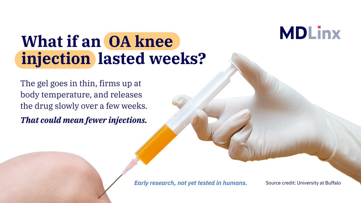 MDLinx's tweet photo. A new gel from UB is runny going into the knee, then firms up and slowly releases the drug for weeks. That could mean fewer OA injections.

It hasn't been tried in people yet.

How many shots a year do your OA patients get? https://t.co/vXxIYP6aIc

#Osteoarthritis #Rheumatology https://t.co/mmvqIY4Heq