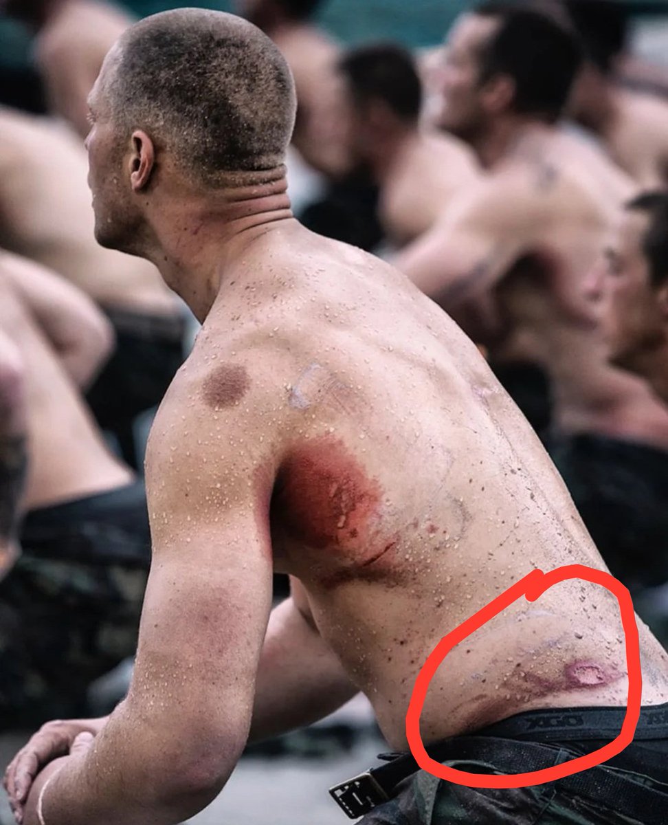 RusttyG's tweet photo. The worst injury unaweza pata ni hii ya lower back na knee juu running ni daily na uko loaded.blisters pia https://t.co/bgaSZmsrtm