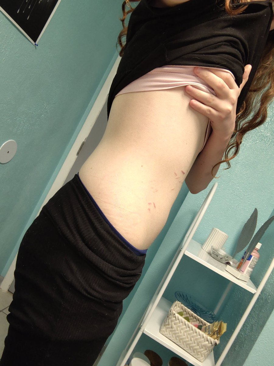 Fatal_angel488's tweet photo. bodycheck from this morning, fat I know  #Ed #Fasting #Edr-twt #moots  #bodycheck (redoing) day one of posting bodychecks everyday so I'll lock in https://t.co/EXrXbae6v2
