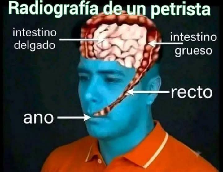 2015_luisfer's tweet photo. @MafeCarrascal @petrogustavo Imagínese, este mesías intergaláctico es su más ilustre lumbrera, que queda para los demás? Puros mamertos descerebrados, delincuentes, chirretes, drogadictos, narcos, terroristas, etc, es la clase de gente que adora al Kakas y le cree cuánta mierda sale de su jeta hedionda. https://t.co/MWlAmy4qGG