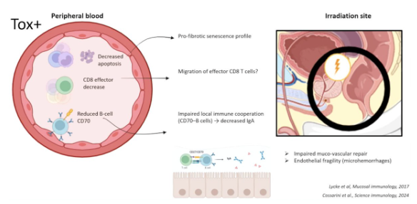 urotoday's tweet photo. Functional radiosensitivity assay identifies immune markers associated with late rectal bleeding after prostate radiotherapy: The #TransPROUST study. Presentation by @DebbiKamel. #ASTRO26 written coverage by @zklaassen_md > https://t.co/giS3Vw11rT @ASTRO_org https://t.co/8WzVqJ6SPP