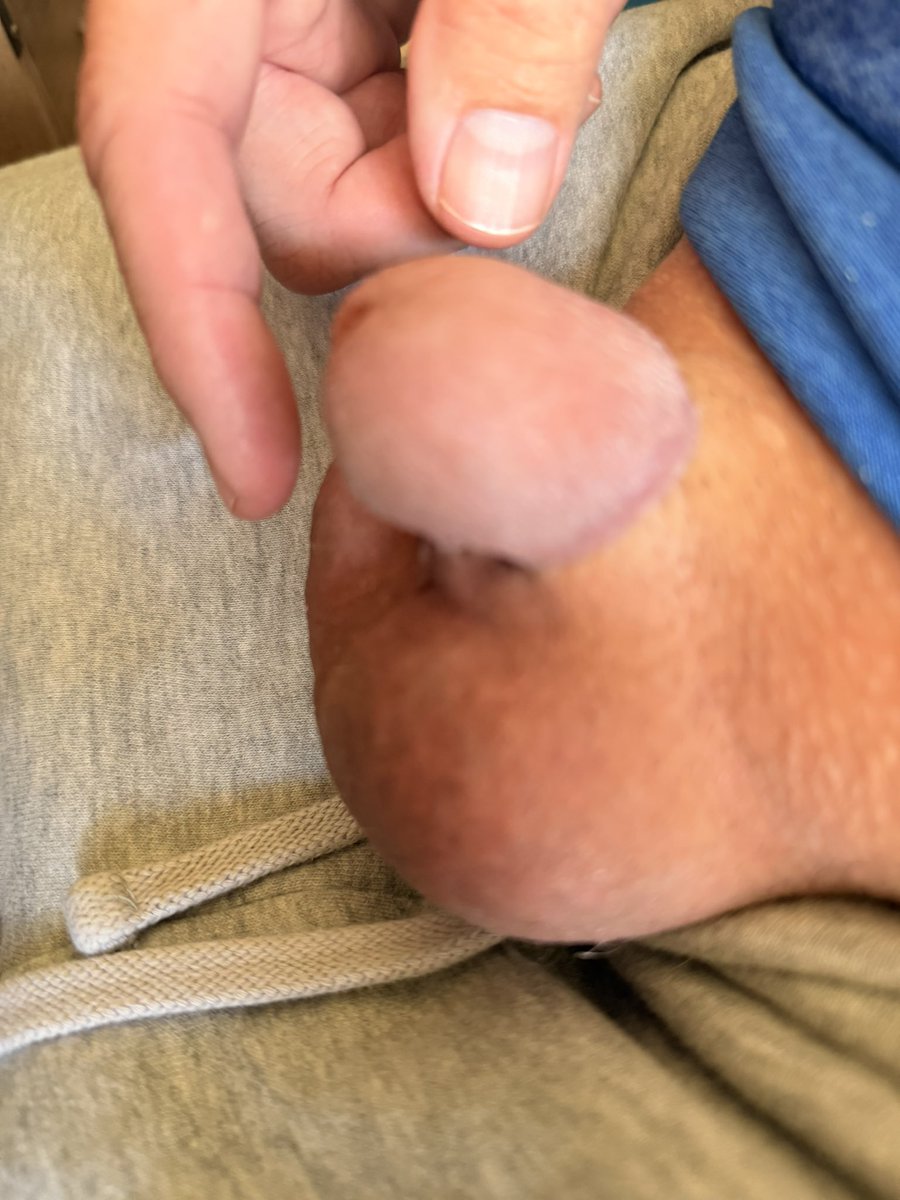 chastityslaveb2's tweet photo. Tucked and #gorillaglued so only her little Tiara is exposed.  #nub #superglue #pussyfree #mushroomcap #smurfhouse #boiclit #lilgurldick #dicklette #nublette #humiliation #cbt https://t.co/P9qbsTCq9e