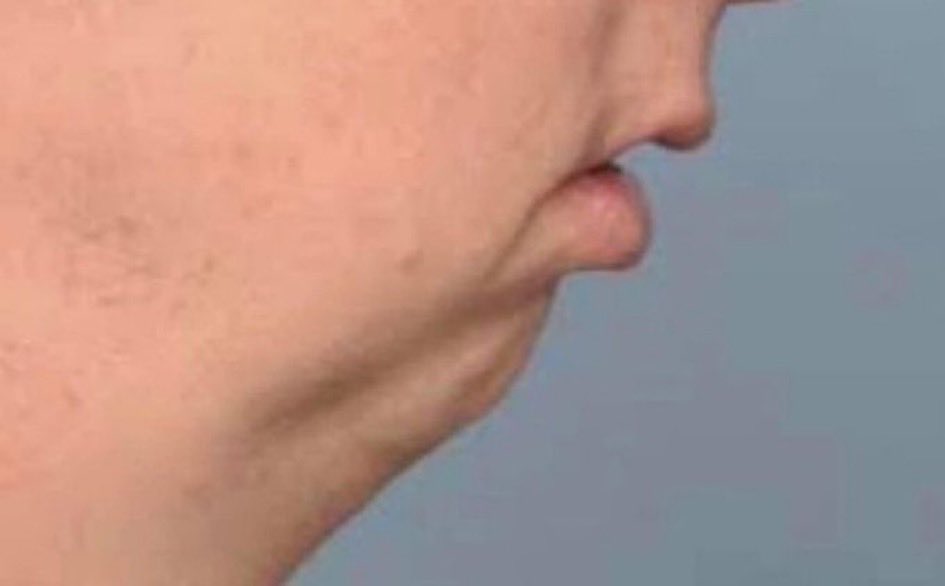 MemeHubCo's tweet photo. @dogeofficialceo Europe spent 2,000 years cooking, painting, building cathedrals and inventing culture just to be judged by a man whose greatest contribution to civilization is this side profile.
Keep cooking fella https://t.co/gHKiktZPMt