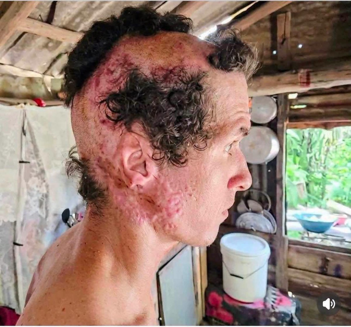 Cubaestadofalli's tweet photo. Joven cubano VÍCTIMA DE EL SERVICIO MILITAR OBLIGATORIO EN CUBA! Discapacitado y ABANDONADO!!! https://t.co/ih3Pdux0gH