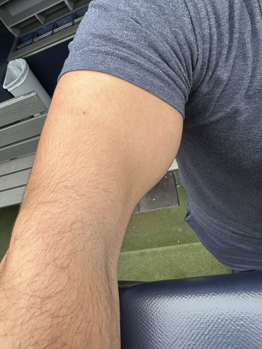 bradfo's tweet photo. Mickey Gasper’s biceps tore off his tendon. He will have surgery in Boston Friday https://t.co/0dPknfy3y4