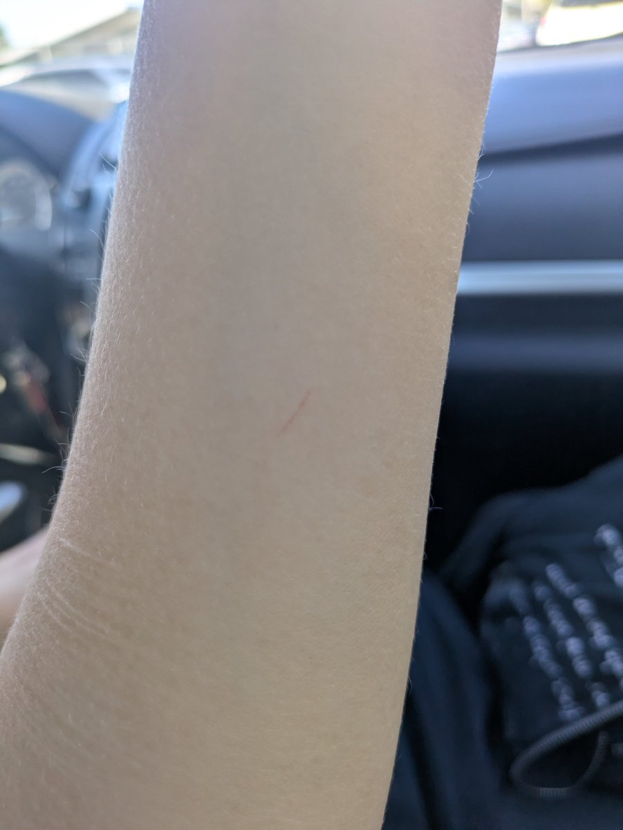 Kokariidex's tweet photo. ⚠️⚠️⚠️ TW VERY SEVERE SH ALL SFX MAKEUP DNI IF IN RECOV !! ⚠️⚠️⚠️
.
.
.
.
.
I think I hit bedrock guys https://t.co/8wquVKwv1F
