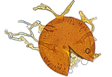 Phytotaxa's tweet photo. Silvaspora fanjingensis and Silvaspora multisubtendens, two new #Sclerocystaceae species of arbuscular mycorrhizal #Fungi (#Glomeromycota) from #Fanjingshan in #China
#taxonomy
https://t.co/fpGYxEQjPP https://t.co/N3gWhGza40