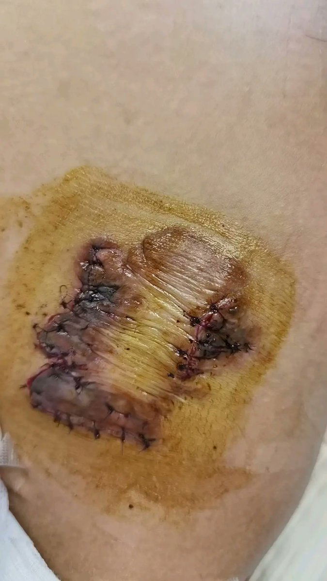b_reth_141_bf4's tweet photo. That scar just gives off a weird vibe https://t.co/qqWaAhEZBb