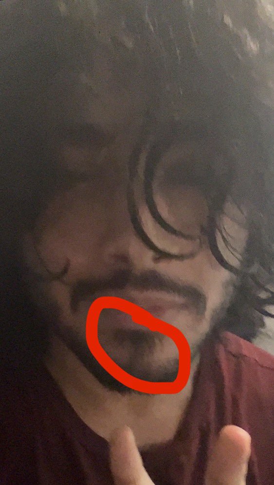 wtfismyissue's tweet photo. @pkmntrainermars @areheon U have literal pubes on ur face please u look a fucking mess https://t.co/uzcz3kvIee