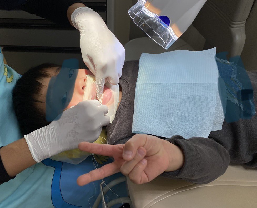AngelDCforkids's tweet photo. 当院の特徴18
・他院で治療不可能だった子がスムースに治療できる(こともある)。
4歳以上の定型発達のお子さんでは協力度の向上はラバーダム使用に負うところが大きい。
器材が粘膜に触れず口の中に水も入らないだけで抵抗感が激減する子も。
もちろん個性、特性によっては順調にいかないこともある。 https://t.co/zqJ1kSrB4t