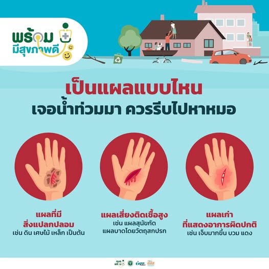 thaihealth's tweet photo. เป็นแผลแบบไหนเจอน้ำท่วมมา ควรรีบไปหาหมอ 😰
.
#สสส #สื่อสารสุข #thaihealth #รับมือน้ำท่วม #น้ำท่วม #แผล https://t.co/cQlltwl3kd