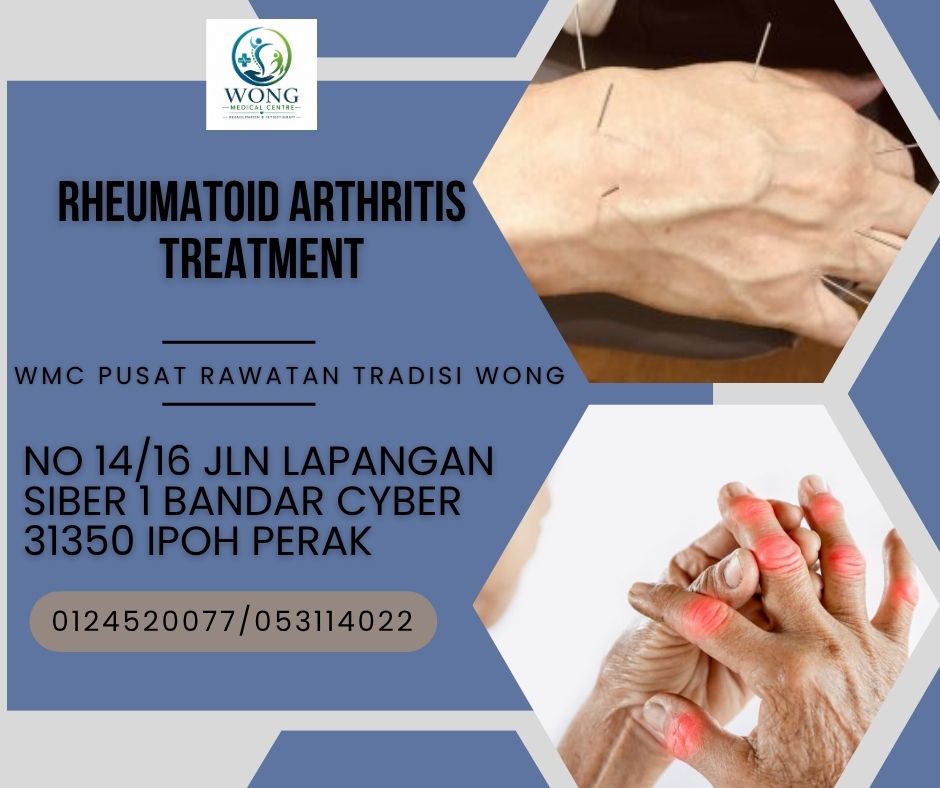 wmcipoh's tweet photo. Rheumatoid Arthritis causing painful swelling, stiffness, and eventual tissue damage. Call us now at number given for more details
#rheumatoidarthritis 
#JointPain 
#acupuncture 
#physiotherapy 
#rehab 
#ipohperak https://t.co/tyxWkevey4