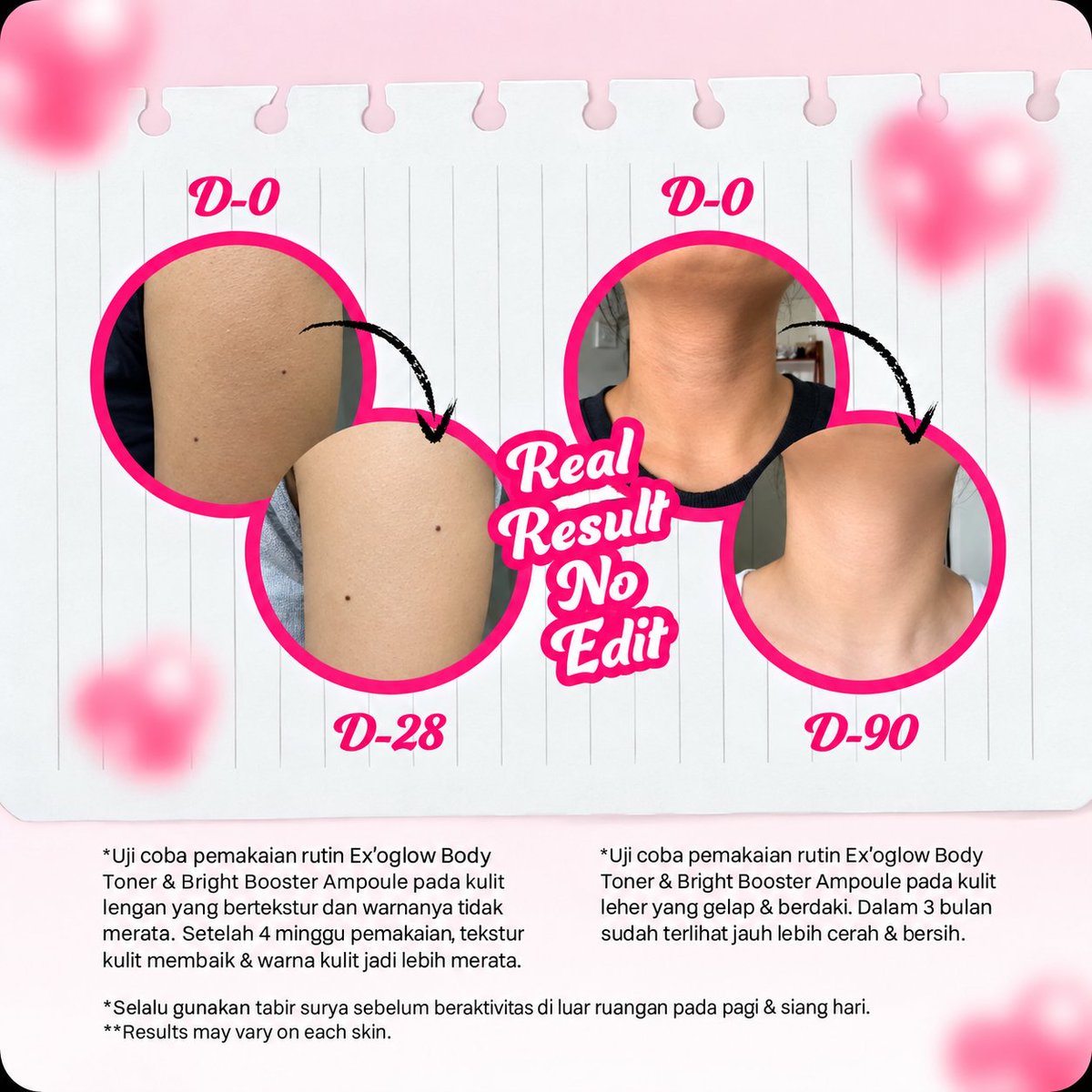 Gemriliant's tweet photo. Nemuin bodycare yang bagus nih! Produk ini bisa digunakan untuk mengeksfoliasi kulit, mencerahkan &amp; meratakan kulit, menyamarkan dark spot, menghidrasi kulit, menghaluskan &amp; memperbaiki tekstur kulit dan menyamarkan bekas luka. Yuk cek disini 👇🏻 

https://t.co/fT73j7NMnQ https://t.co/4JRVCifT1i