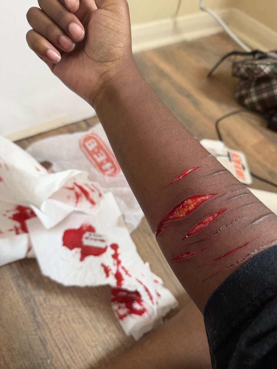 Larpofslittwt's tweet photo. FAKE SFX AI, NOT REAL, HALLOWEEN MAKEUP, HYPER-REALISTIC PAINTING

Re-upload since the wanted to take my post down. This isn’t real !!! https://t.co/4Ir8LToHzx