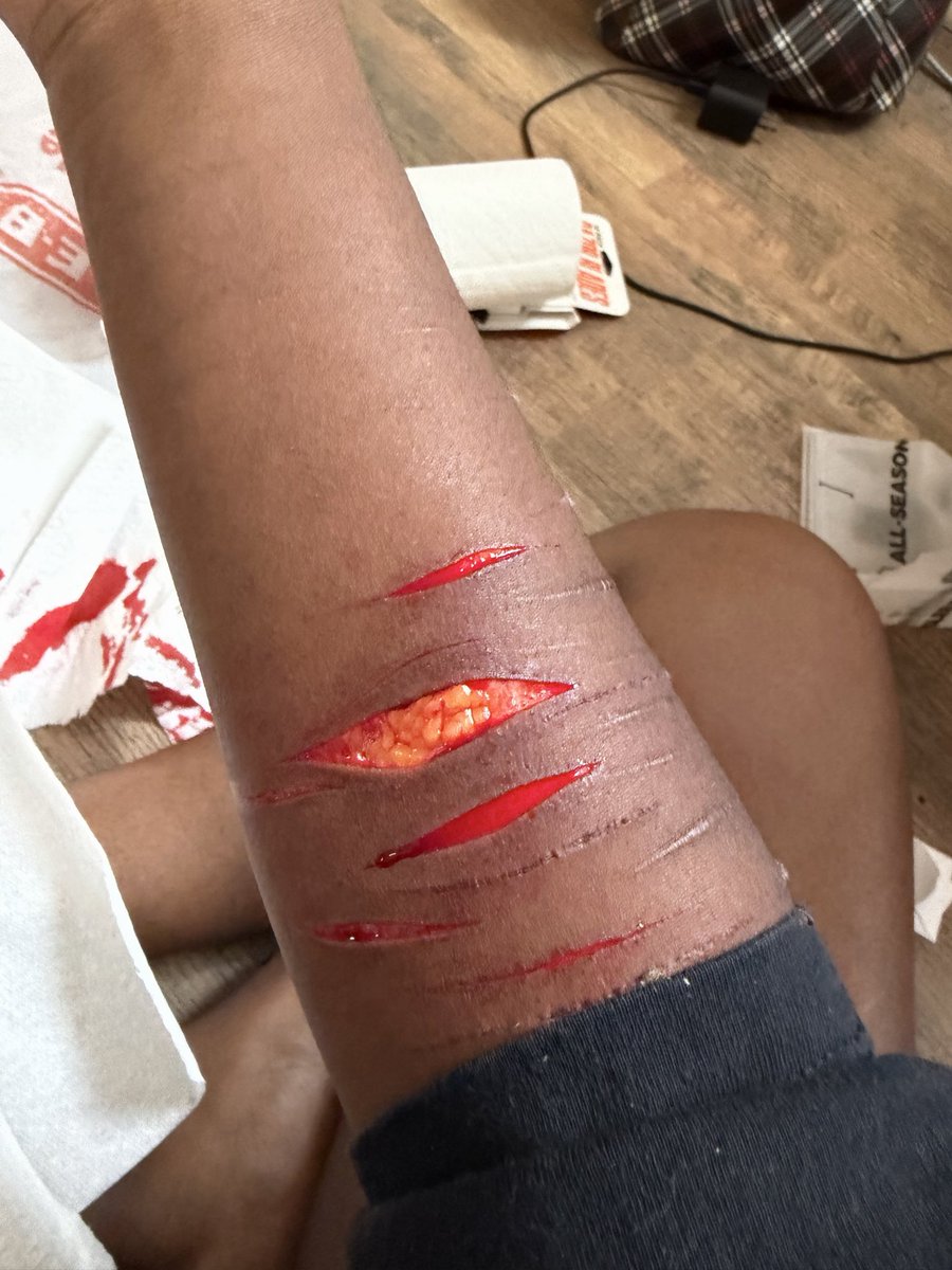 Larpofslittwt's tweet photo. FAKE SFX AI, NOT REAL, HALLOWEEN MAKEUP, HYPER-REALISTIC PAINTING

Re-upload since the wanted to take my post down. This isn’t real !!! https://t.co/4Ir8LToHzx