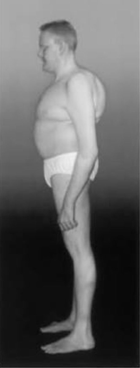 PTCruiserAndy's tweet photo. @Acyn Bro talk to me about medical issues #testosterone #estrogen #TeslaTorso https://t.co/4vD16cxGll