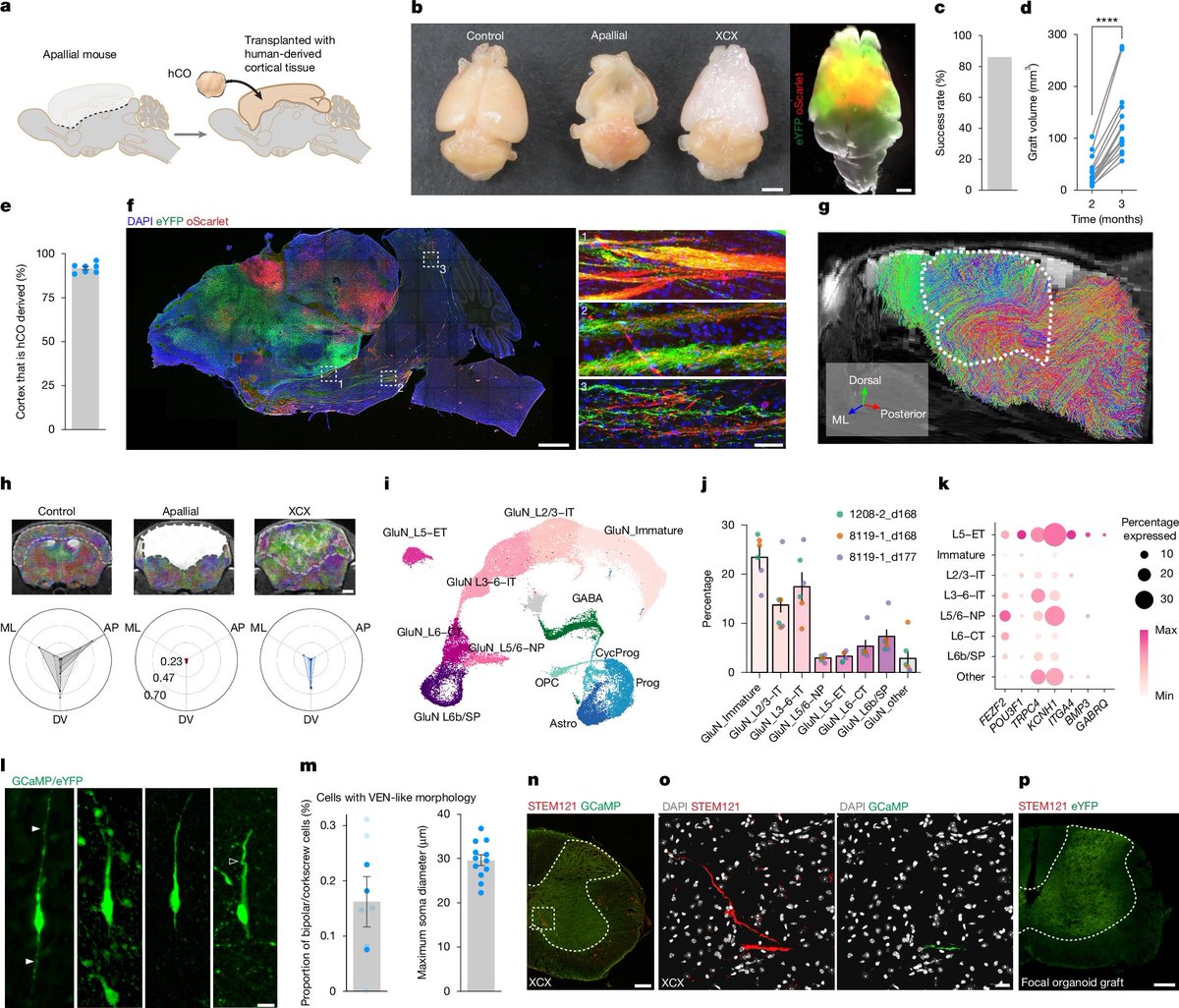 wirthstef's tweet photo. This #sciencewriting #article explores #organoids and them remaining functional when #implanted into #mousebrains.
What distinguishes an organoid from a standard cell culture in a Petri dish? And how does an organoid differ from a real organ? To be #classified as an organoid, the structure must be #threedimensional and composed of various #celltypes that #communicate with one another. The #tissue must utilize specific cell-to-cell communication pathways that correspond to the function of the #organ it replicates.
How are organoids produced? In the case of human organoids, they are derived from human cells obtained from donors. These cells are subsequently reprogrammed into a state of #pluripotency. Because they grow in non-adherent vessels, they cannot arrange themselves two-dimensionally along the vessel walls; instead, they are forced to connect with one another in three dimensions. Organoids lack blood vessels. To ensure that all cells receive sufficient #nutrients and #oxygen, the organoids must be kept small and kept in constant motion; this ensures a consistent supply to individual cells via the diffusion of nutrients and oxygen through the tissue.
To determine which type of organoid develops from the stem cells, the cells are exposed to #biochemicalconditions that block all developmental pathways other than that of the desired organ.
#Brainorganoids derived from human stem cells are of particular interest to the scientific community because these "#minibrains" are highly sophisticated structures characterized by complex #neurologicalconnections. Human brain organoids are capable of #learning and #solvingtasks. The field known as #brainorganoidcomputing (often referred to as #biocomputing or #organoidintelligence) integrates #biology, #electronics, and #computerscience. For example, researchers have already trained flat 2D networks of brain cells (#DishBrain), as well as newer #3DBrainoware systems, to solve simple #tasks. The 2D networks were able to dynamically adjust the movements of the paddle in the #videogame #Pong using electrical feedback, while the 3D Bainoware systems (organoids) solved more complex #mathematical and processing tasks. While the concept of biocomputing may sound futuristic, it has actually reached a remarkably advanced stage of development.
Are human brain organoids merely research models, useful at best for biocomputing, or are they also suitable for transplantation and capable of integrating with a living brain to perform specific tasks within it?
K. Kaganovsky et al. (2026) addressed this very question by transplanting sections of a #humanbrainorganoid into the brains of #mice that had previously undergone the removal of corresponding brain regions. The experiment was successful: neurons from the human organoid graft connected with the mouse brain's nerve cells and assumed functional roles, whereby the transplant became #synapticallyintegrated with the mouse's #sensorynetworks.The #study also raises #ethicalquestions regarding future boundaries in the creation of #humananimalhybrids.
© #StefanFWirth, September 2026, Berlin
Please support my science writing: ko-fi 👇 link in my first comment
Reference:
K. Kaganovsky et al. (2026):
DOI: 10.1038/s41586-026-11032-2 👇 link in my first comment
#Illustrations:
© Stefan F. Wirth; AI-assisted illustrations based on my hand-drawn sketches, manually edited; September 2026, Berlin.
1)–3) Artistic illustration of a house mouse and a human with their brains; morphology of an isolated mouse brain.
#Figure:
Transplantation of human #corticalorganoids into the #apallialmouse. d, Increase in graft volume from 2 to 3 months post-transplantation. n = 14 mice; 8119-1 and 0524-1 cell lines; each dot represents a single mouse and each line connects the same mouse across timepoints).
by authors K. Kaganovsky et al. (2026), licensed under creative commons NonCommercial-NoDerivatives 4.0 International License, 👇 link in my first answer