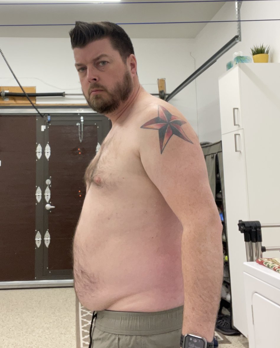 JeffHacksHealth's tweet photo. @benhackshealth @HackingDave @wehackhealth Whenever I hit a setback, I am always reminded of this picture which pretty much represents a rock bottom period where I realized I had enough, and there would never be a right time. https://t.co/3iqQcbyRhg