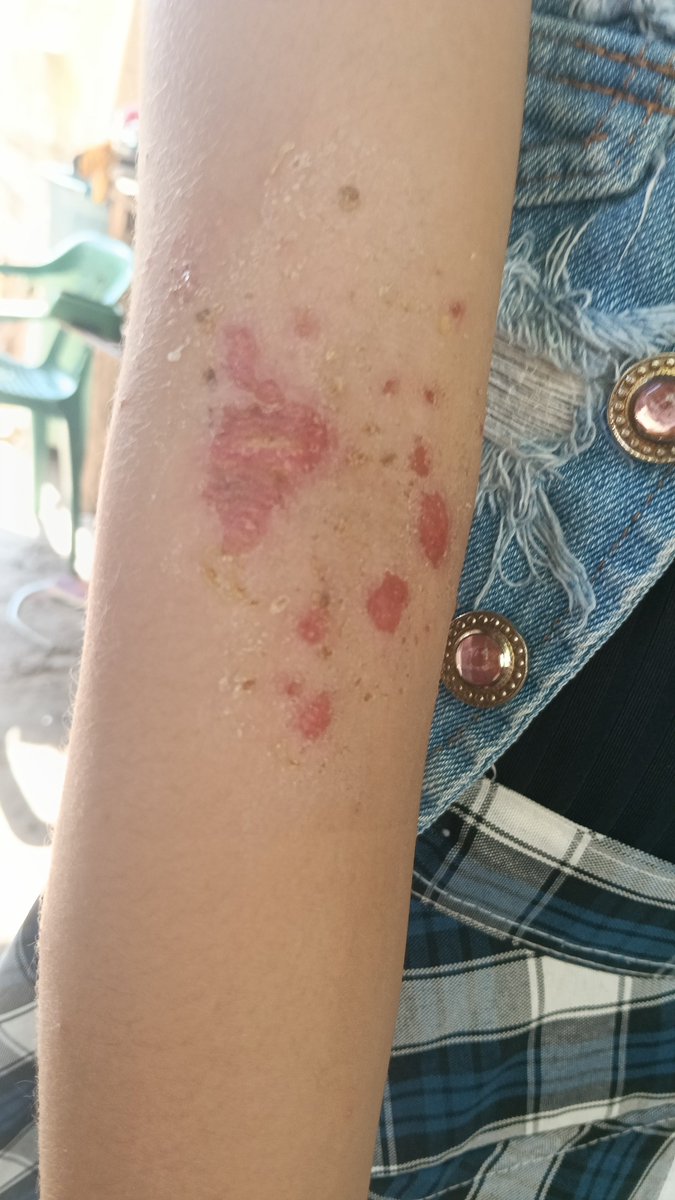 Alejand92128200's tweet photo. @AsmetSalud como es posibl q la farmacia del guamo tiene 2 empleadas para entregar medicamentos y no hay nada para entregar, fuimos hoy para la entrega d estos medicamentos y no hay nada, cuando el médico fórmla es xq se necesitan los mdicamentos no es x perder tiemp @Supersalud https://t.co/UvDk4wSEBP