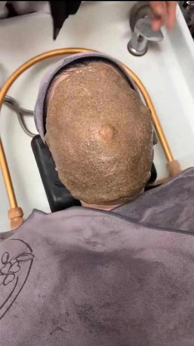 vyaaa_03's tweet photo. Susah payah ngerayu suami biar boleh spa sendirian, eh malah dapet terapis baru🤏🤧

Masker dipasang tanpa lubang napas. Baru 5 menit udah panik, akhirnya aku tarik sendiri 😭🫵 Terapisnya malah kesel karena katanya “memang prosedurnya begitu” 

Ini aku spa atau uji nyali si😫 https://t.co/vL3p5lvUe5