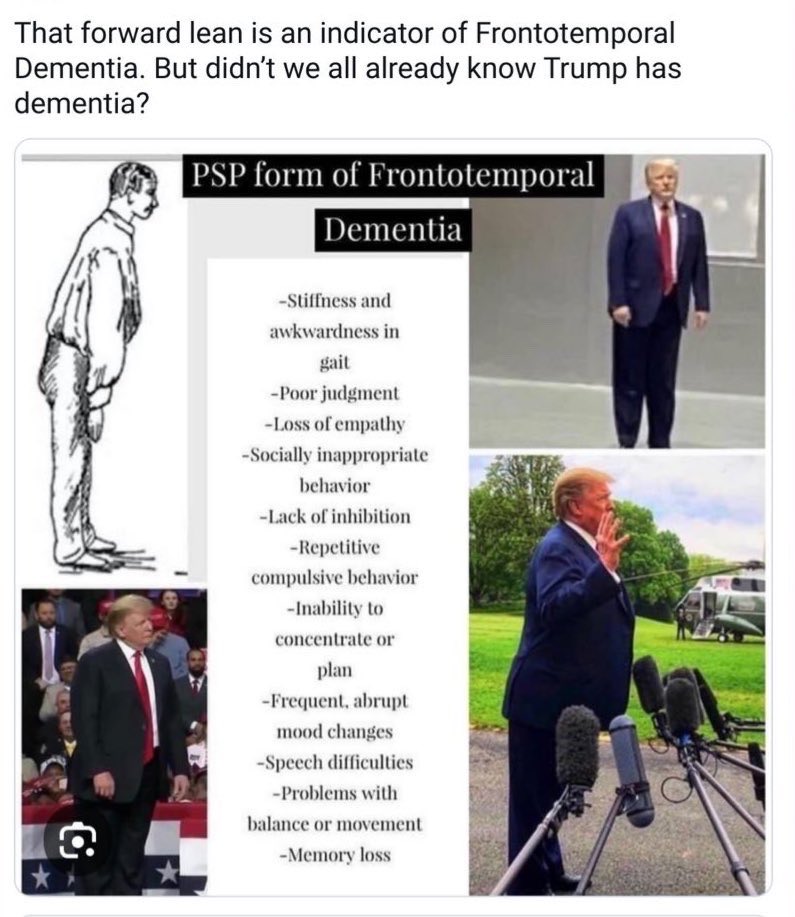 lvhothead2483's tweet photo. @DougWahl1 No one is talking about it, but he really, really has THIS: https://t.co/KoMoeJu1n3