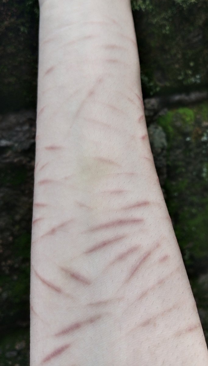melankoliii___'s tweet photo. Wish they would never fade
Wish I wasn't so alone

SFX makeup practice for today, all are FAKE realistic drawings made with AI asistance
#slittwt #988twt #selfharm https://t.co/OfojofbS5u