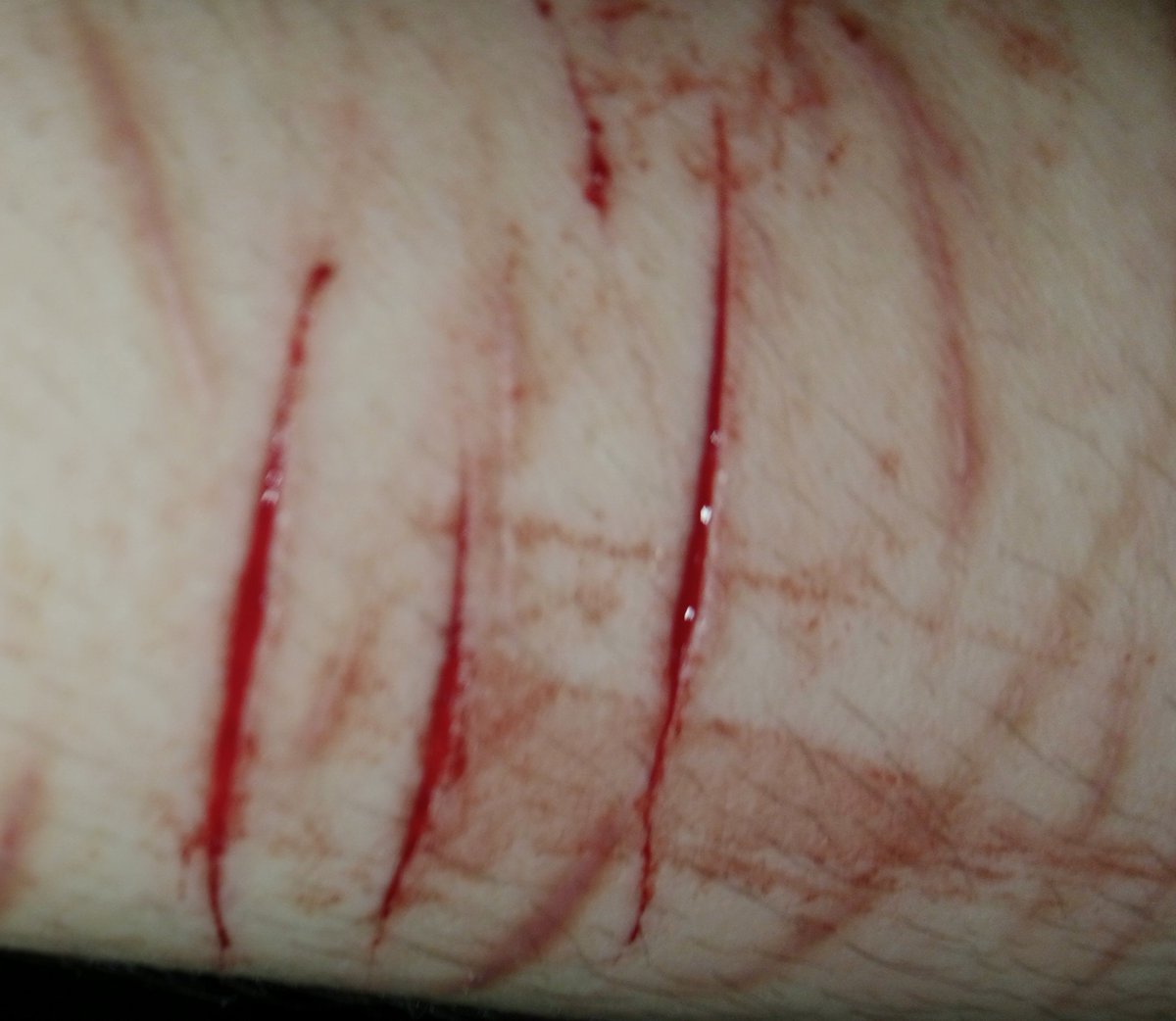 melankoliii___'s tweet photo. Wish they would never fade
Wish I wasn't so alone

SFX makeup practice for today, all are FAKE realistic drawings made with AI asistance
#slittwt #988twt #selfharm https://t.co/OfojofbS5u